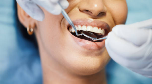 Best Emergency Dentist for Lost Fillings or Crowns in Paradise, NV